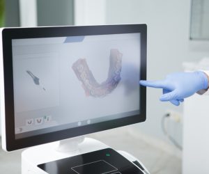 Protetika zuba Dental Centar Grebenar